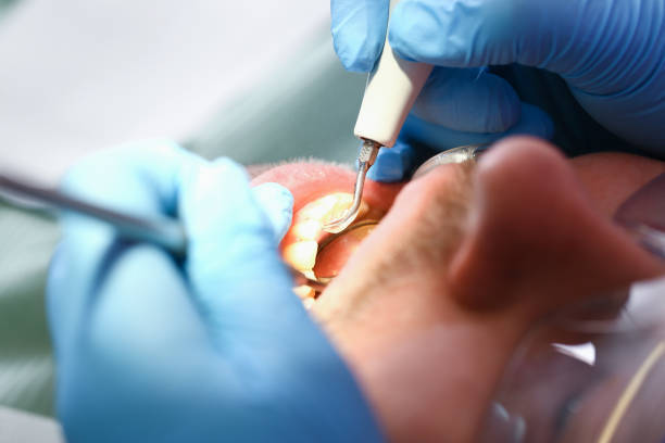 Best Walk-In Emergency Dental Services in Sawmills, NC