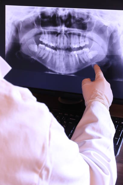 Best Knocked-Out Tooth (Avulsed Tooth) Treatment in Sawmills, NC